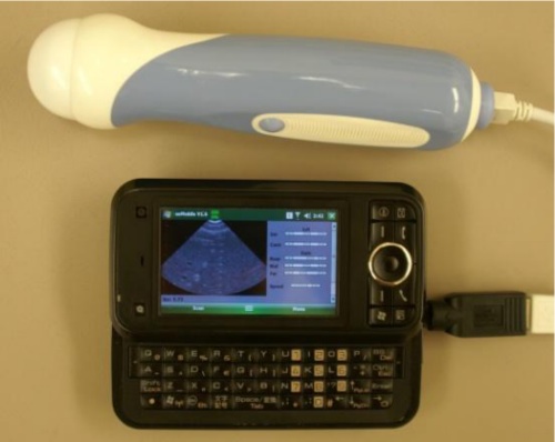 usb ultrasound windows mobile.jpg