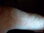 Gear Diary Meet Winston Kemp, Lightning Strike Survivor and Lichtenberg Figure Owner photo